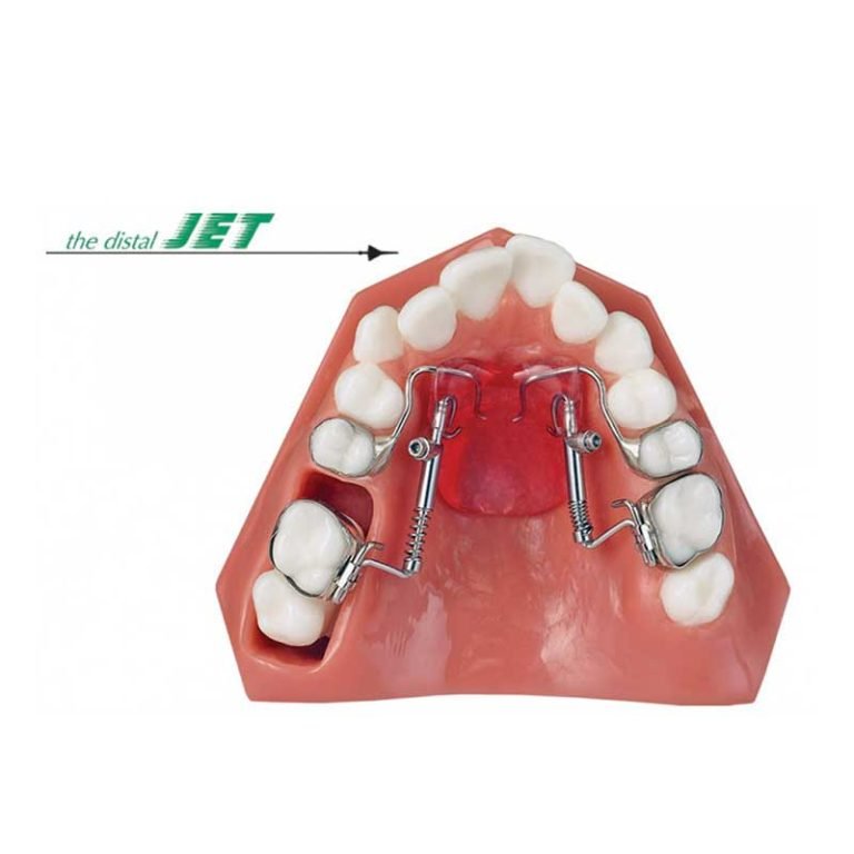 AMERICAN ORTHODONTICS / DISTAL JET - Synergie Medicale Maroc