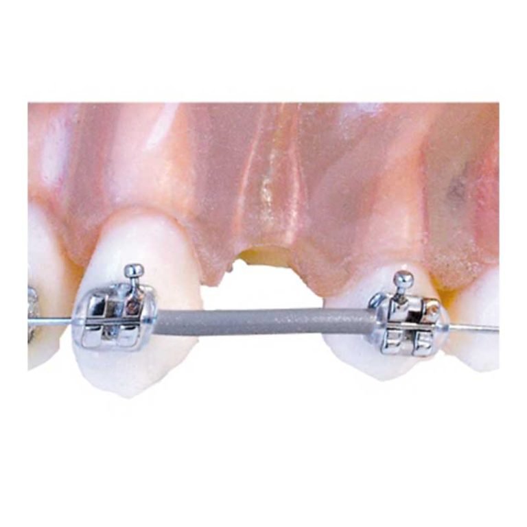 American Orthodontics / Gaine de protection - Synergie Medicale Maroc
